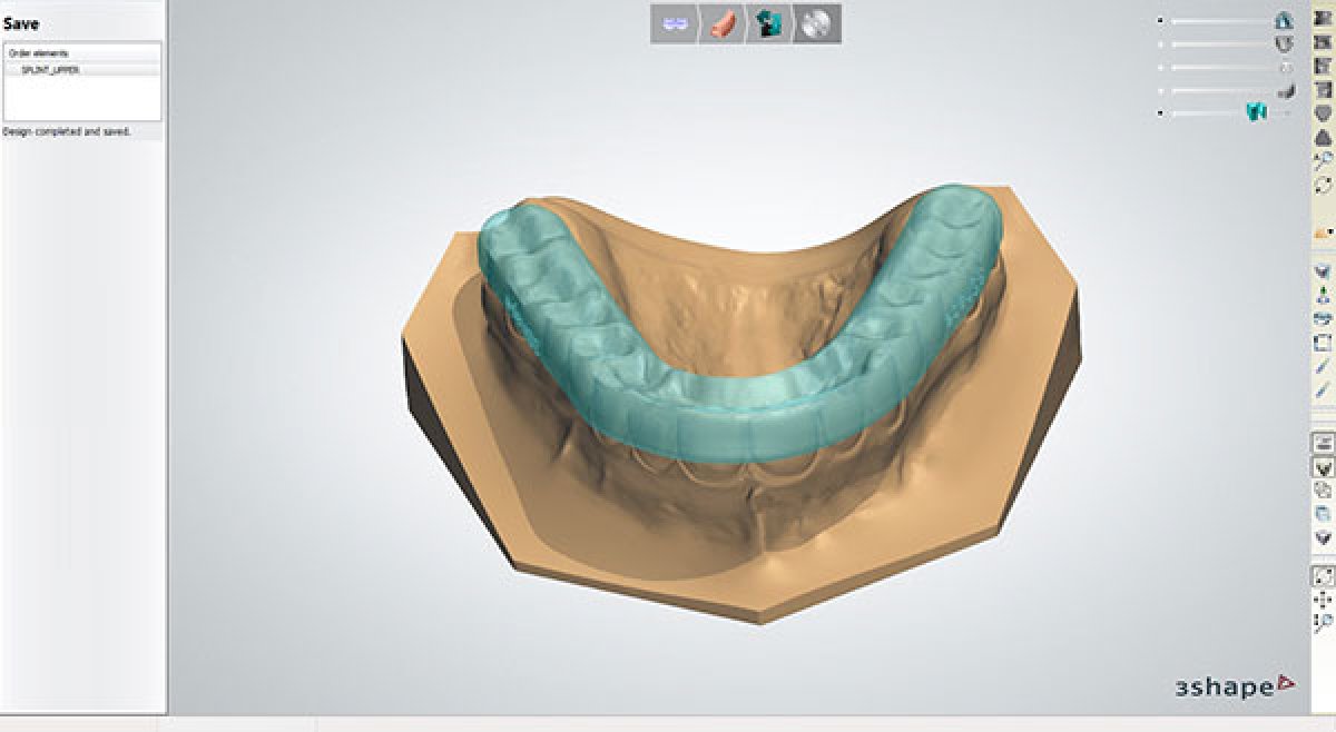 Die neue Splint Designer™ CAD-Software von 3Shape bietet neue Geschäftsmöglichke
